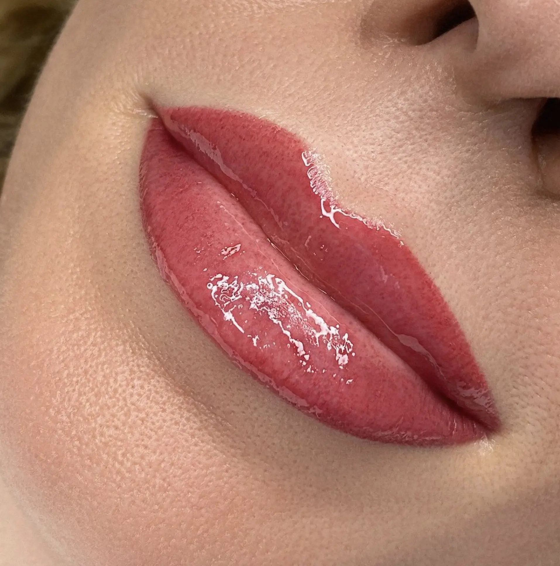 dark lip neutralization