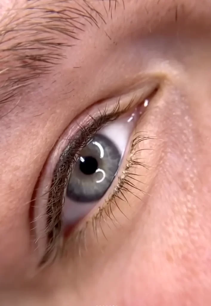 How It Compares To Other Lash Treatments